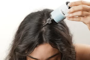 scalp serum