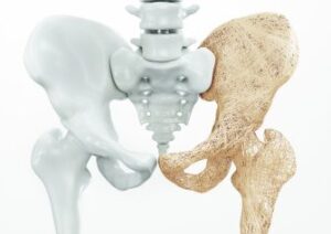bones picture
