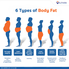 obesity picture