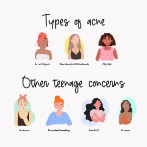 teenager acne